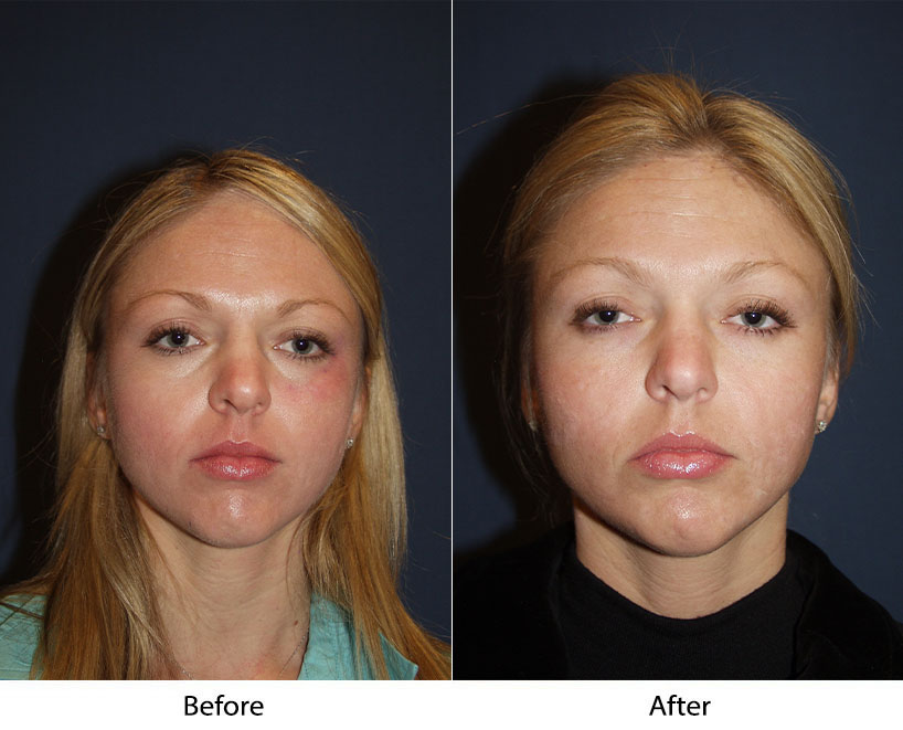 Information about different kinds of facial plastic surgery procedures