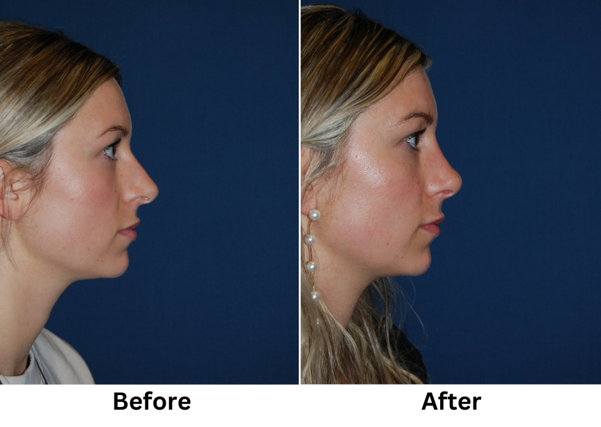 Charlotte’s Best Facial Plastic Surgeon: Cosmetic vs Reconstructive Surgery