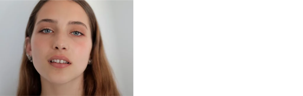 Benefits of Teen Rhinoplasty Charlotte, North Carolina Banner